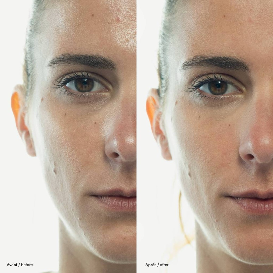 L73 before and after